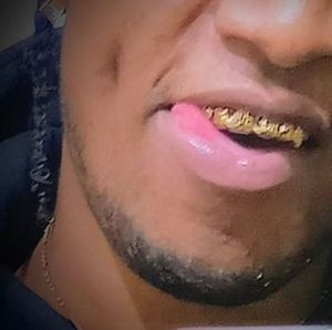 Meet your Posher, Drizzy